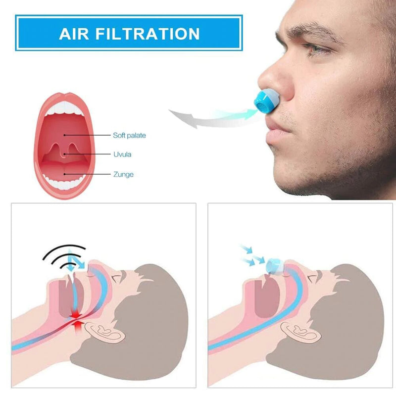 Airing - Anti Snoring Device | Hoseless, Maskless Micro CPAP