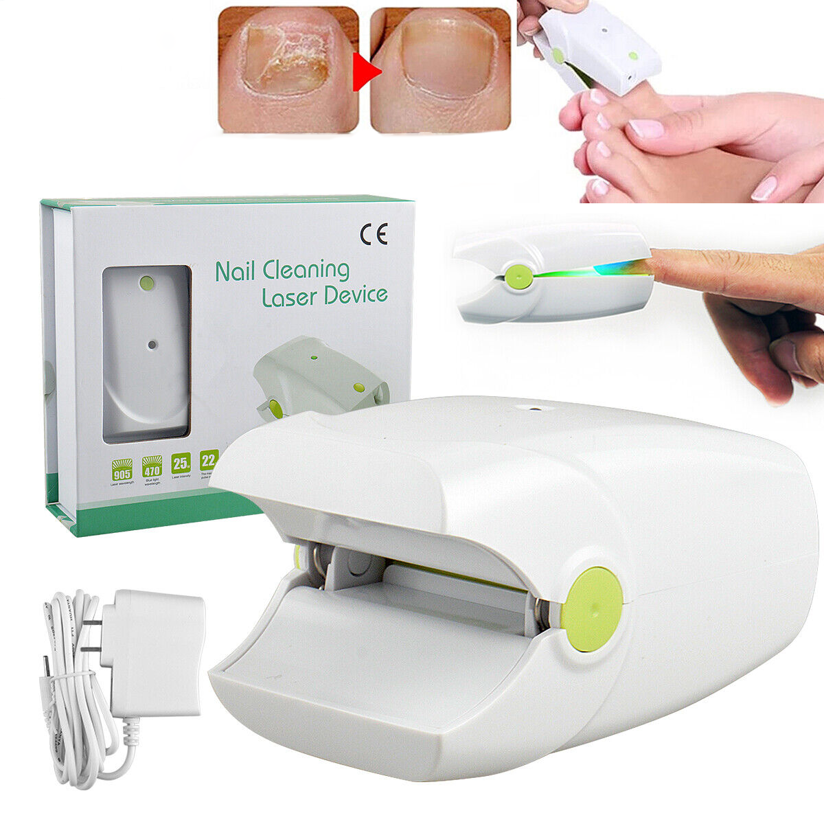 Toe And Fingernail Nail Fungus Treatment Laser Device