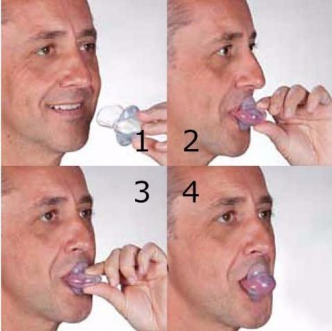 Apnea Tongue Stabilizing Device