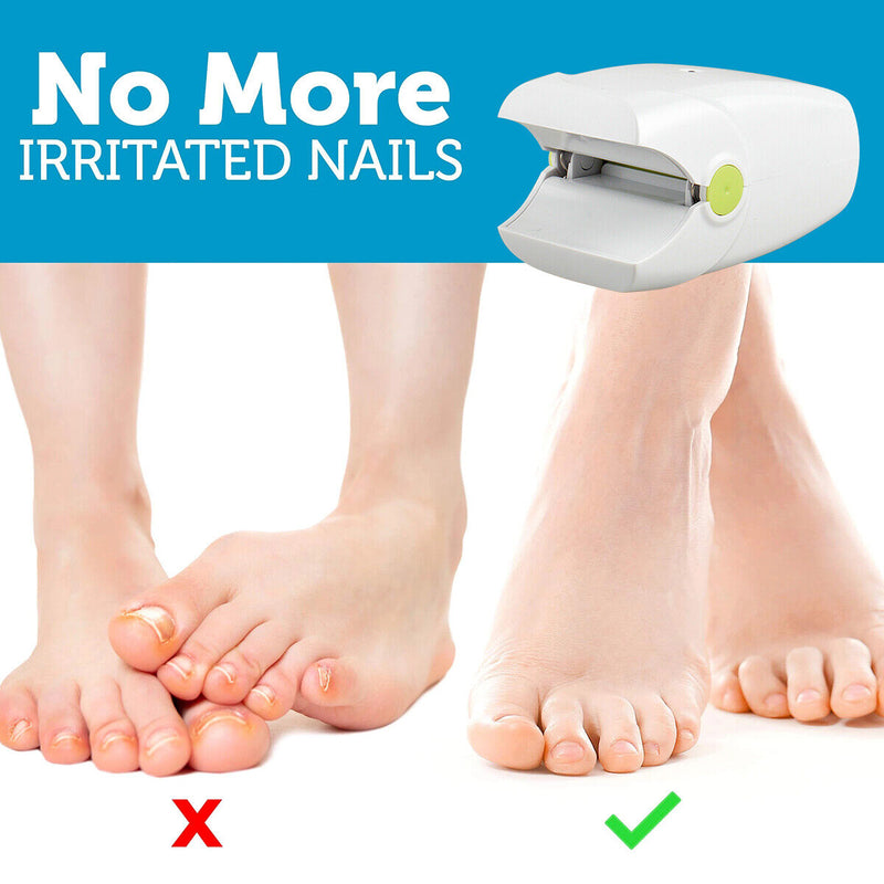 Toe And Fingernail Nail Fungus Treatment Laser Device